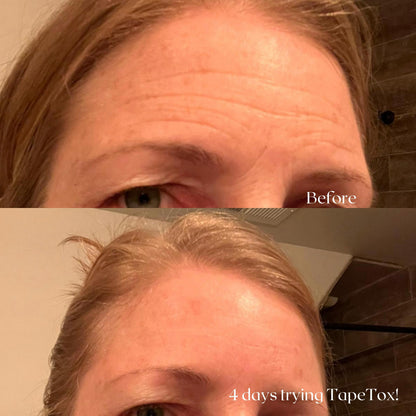 TapeTox Natural Wrinkle Smoothers! TikTok Viral!